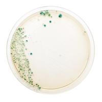 Bacteria in petri dish